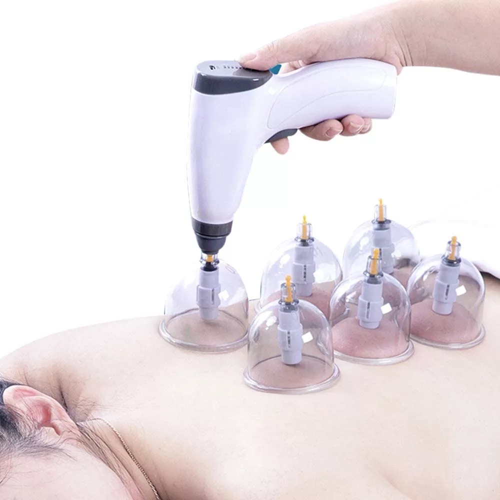 Mangkuk isap elektrik antitell - Cupping Therapy Set ulasan dan harga