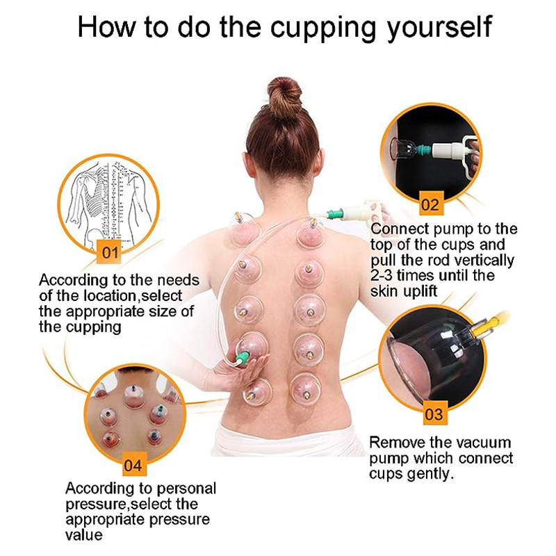 24 Kaleng JINGKANG Set Alat Be - Cupping Therapy Set ulasan dan harga